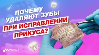 ПОЧЕМУ для исправления прикуса приходится УДАЛЯТЬ зубы? // 