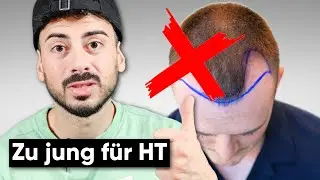 Daven (23) bereut seine Haartransplantation | 10 Tage nach der Haar OP