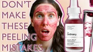 CHEMICAL PEELS: How To Prepare Your Skin For The ordinary Aha Bha Peeling Solution (Or Other Peels)
