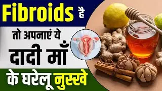 फाइब्रॉएड  का देसी इलाज | Fibroid ke Gharelu Nuskhe | Natural Fibroid Remedies | Fibroid Treatment