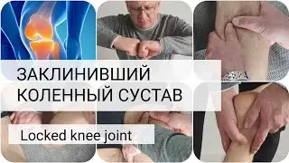 Если заклинило колено! Боль в коленном суставе/ Locked knee joint/ 