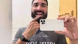 Agora é pra valer, iniciei o tratamento com aparelho móvel INVISALIGN