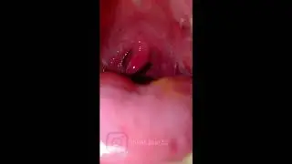 Playing with my UVULA  | VORE UVULA #UVULA #VORE