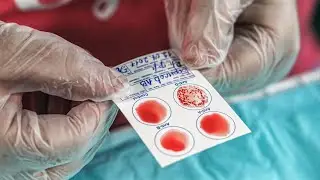 How to Test Your Blood Type at Home