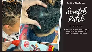 Scratch Patch #2 IT CRACKED!!