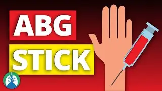 How to Stick an ABG (Arterial Blood Gas) | Respiratory Therapy Zone