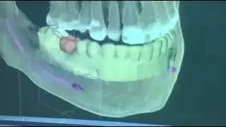 Курс Sirona 06 17