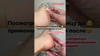 #pixeltap # lanolin #пяточнаяшпора #гладкаякожа #маникюр #наращиваниеногтей