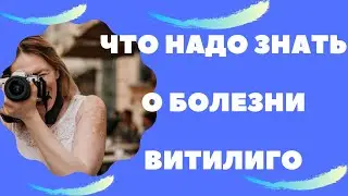 Белые Пятна на Лице и Теле - Что Надо Знать о Кожной Болезни Витилиго