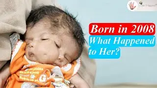 Lali The Girl with Two Faces | Who's To Blame? ~ Body Bizarre!