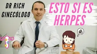 Este grano es herpes vaginal?