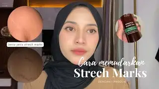 STRECH MARK MEMUDAR! Review Rintik Strech Mark Oil Viral! Worth it?✨💫
