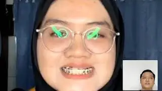 Melawan Polio : Perjalanan Menuju Dunia Bebas Polio | Epid Talk Ep.15