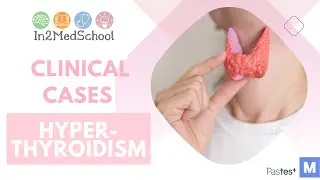 Hyperthyroidism Clinical Case