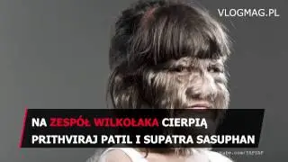 NAJDZIWNIEJSZE PRZYPADKI MEDYCZNE. TEGO JESZCZE NIE WIDZIAŁEŚ [VLOGMAG]