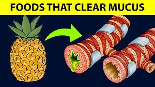 Top 8 Foods That Cleanse MUCUS