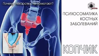 Психосоматика проблем с копчиком