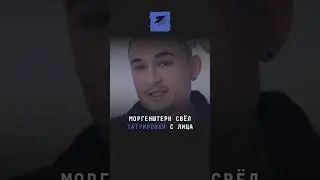 Моргенштерн свёл татуировки с лица 