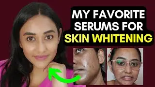 Top 5 Powerful Skin-Whitening Ingredients and My Favorite Skin-Whitening and Depigmenting Products