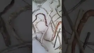 хомякоз диагноз мой))))))