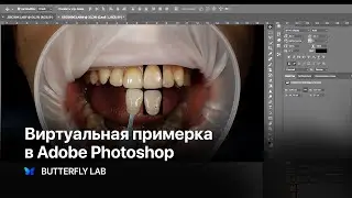 Virtual fitting - How a dental technician can use Adobe Photoshop in work - Butterfly Lab