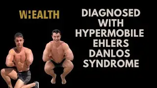 Diagnosed with hypermobile Ehlers Danlos Syndrome (hEDS)