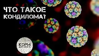 Что такое кондилома?