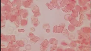Влияние алкоголя на кровь человека