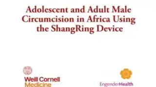 A step-by-step No-Flip ShangRing Male Circumcision Surgical Training in Africa (2017)