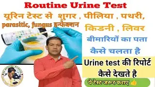 urine test report देखना सीखे || Urine test report explain ||Urine test in Hindi |#urine