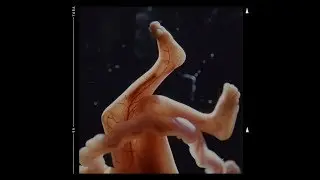 Marracash x Rkomi type beat ~ life [beat n.47]