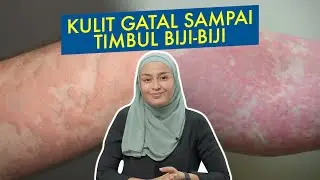 Kulit Gatal Sampai Timbul Biji-Biji
