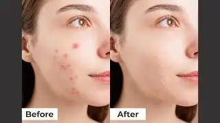 Skin Retouching Photoshop Tutorial is SO EASY!