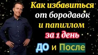 Как избавиться от бородавок и папиллом за 1 день