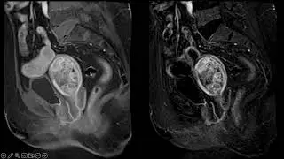 5 minute Interesting case by Dr. Amit Patle