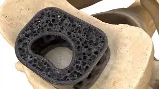 Modulus Cervical - Product Animation