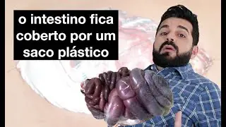 Homem ficou com órgãos para fora!
