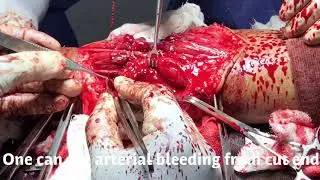 Hand Surgery, Microsurgery, Vascular Surgery, Nerve Surgery, Tendon Surgery, Trauma