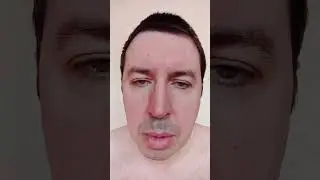 Появление родинки