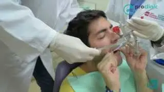 Cap. 13 y 14 - El material básico de impresión y prótesis dental