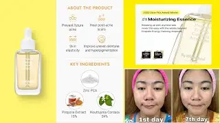 BY WISHTREND PROPOLIS ENERGY CALMING AMPOULE | A 7 Day Test