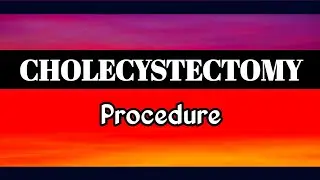Cholecystectomy Procedure | Cholecystectomy Surgery 