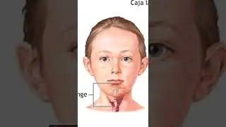 THE SAD STORY OF THE CASTRATI