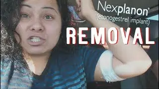 Nexplanon Removal / My Experience
