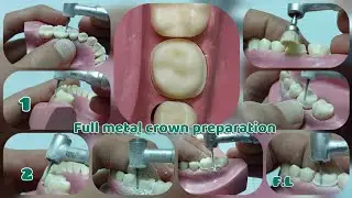 اسهل فيديو لتعليم Reduction for lower 6 _ full metal crown preparation