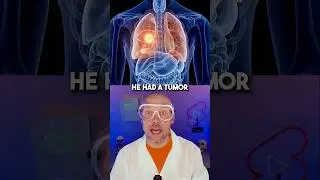 Strange things found in humans