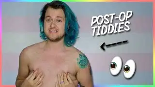 6 YEARS POST-OP | FTM TRANSGENDER [CC]