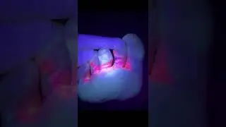 Don’t Shine a Black Light on Your FEET!🤯