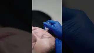 Aquagold Facial at Bellair Laser Clinic