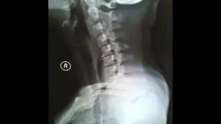 LA FIN DU MAL DE DOS EN 3 EXERCICES